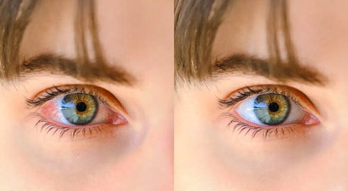 Spring Lash Detox: Why Your Lashes Need a Reset This Season